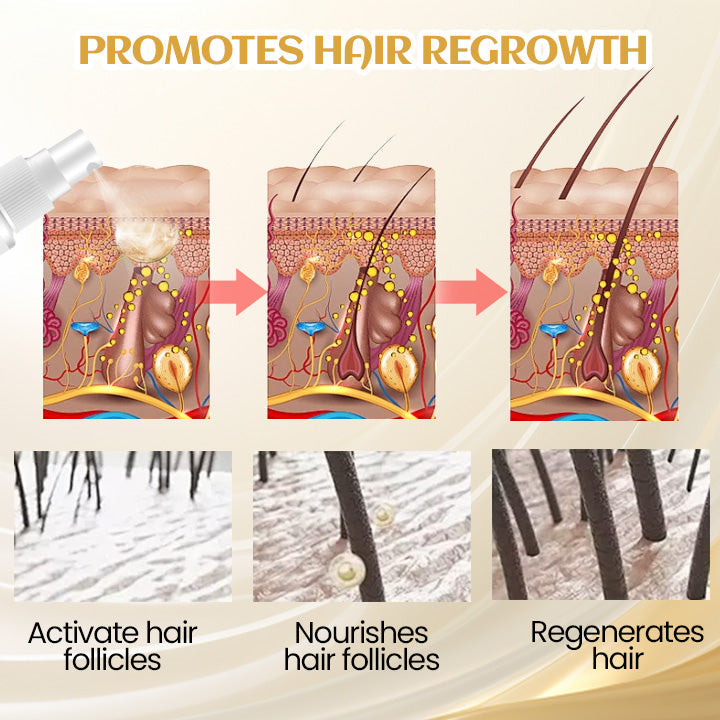 Cvreoz® Ginger Hair Regrowth Serum🔥HOT SALES 60%🔥