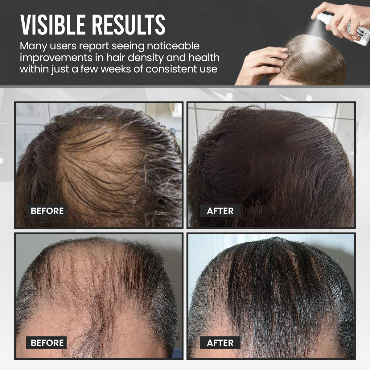 ⏰FLASH SALE: 60% OFF🔥Cvreoz® DermaThick Hair Growth Elixir