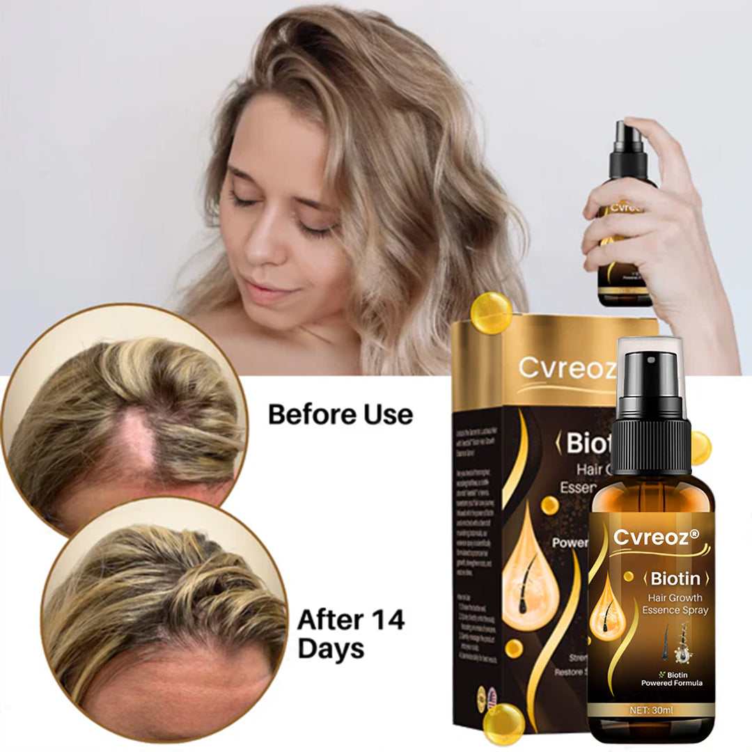 Cvreoz® Biotin Hair Growth Essence Spray🔥 Last Day Sale Off 60%🔥