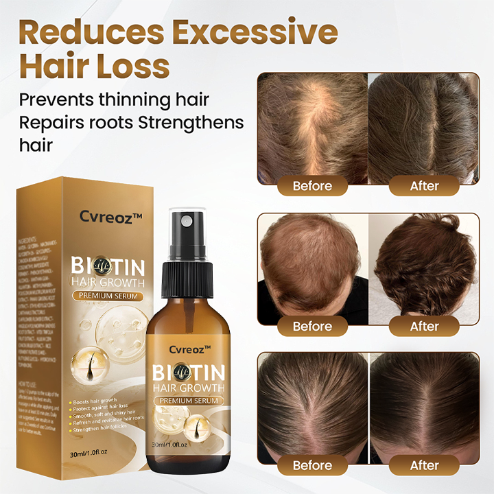 Cvreoz® Biotin Hair Growth Premium Serum - Proven and Tested by Experts! 👩⚕️