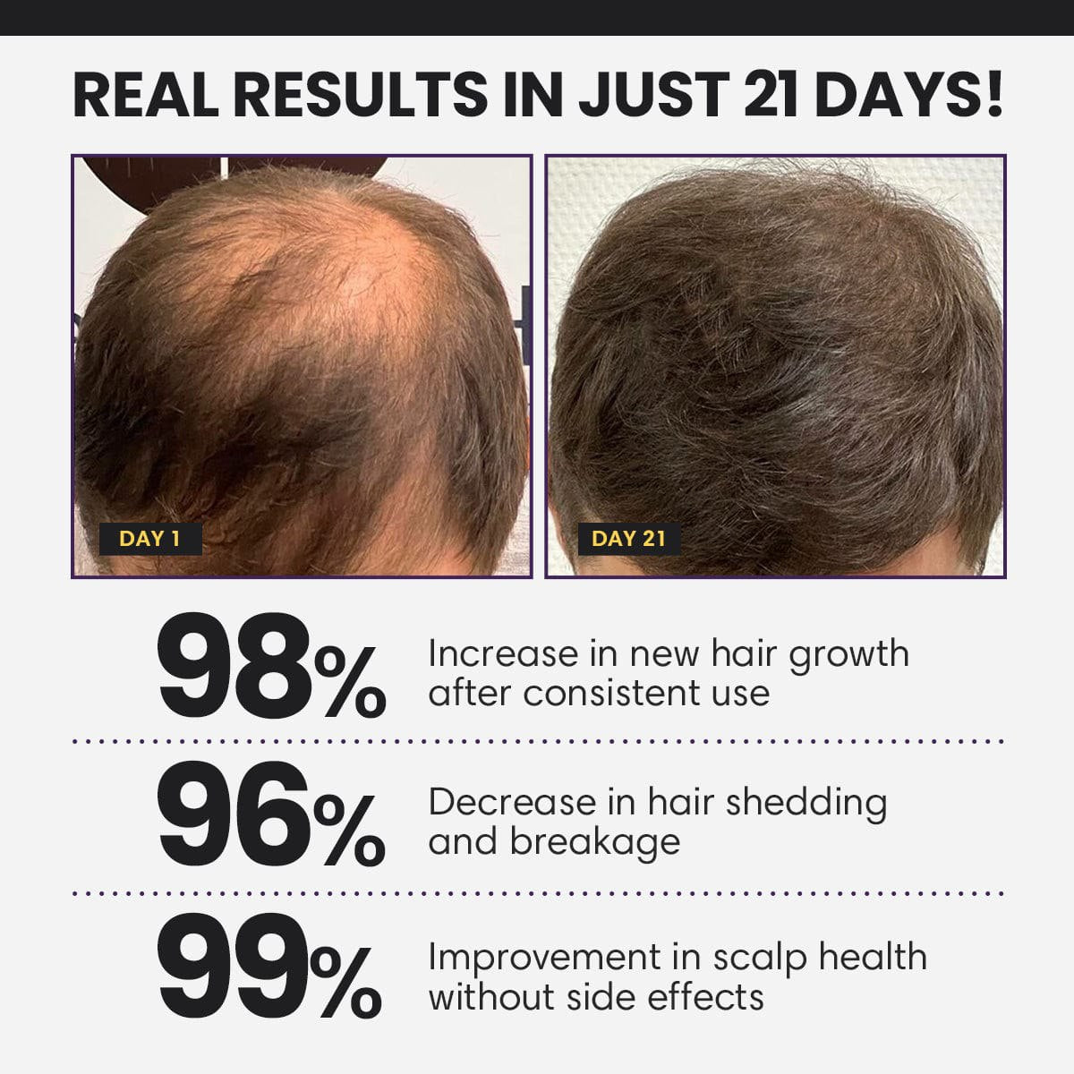 ⭐ CVREOZ® FollicleBoost 5X Hair Growth Serum 🪮