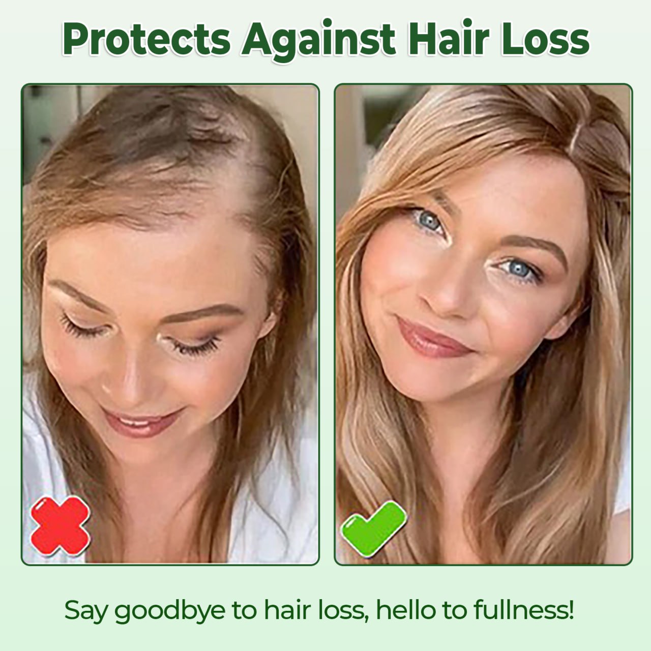 CVREOZ® Rosemary Hair Growth Spray 💥Sale Up to 60%💥