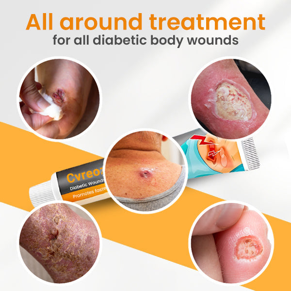 Cvreoz™ Diabetic Wounds Treatment Cream ⏳ Limited Stock – Order Now!⚡