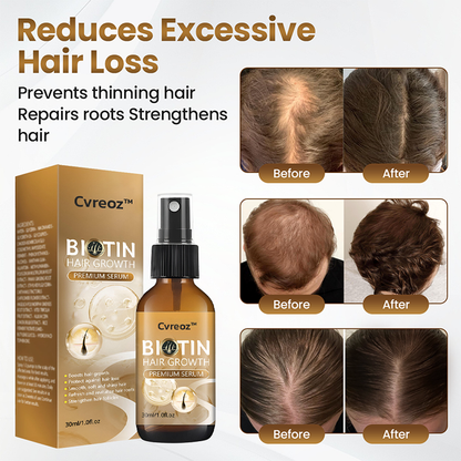 Cvreoz® Biotin Hair Growth Premium Serum - Proven and Tested by Experts! 👩‍⚕️
